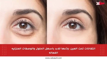 انتفاخات تحت العين: ودّعها للأبد بأسهل الحلول والوصفات المنزلية الفعالة